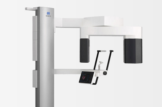 デジタルレントゲン